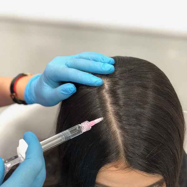 Мезотерапия для волос, что это такое за процеДypa 
