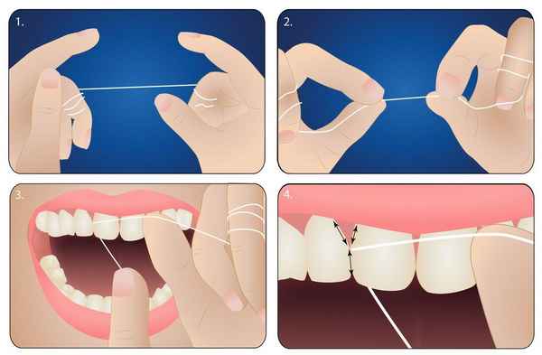 Зубная нить: как правильно пользоваться зубной нитью 