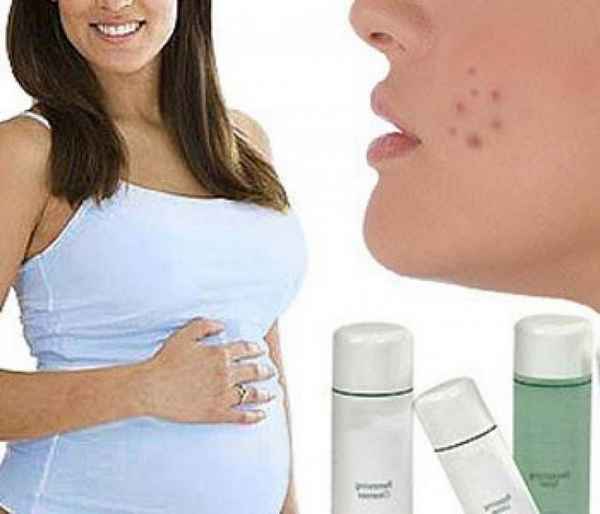 Прыщи на лице при беременности 