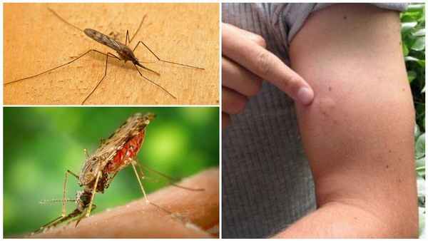 Укус комара: возможные последствия укусов этих вредителей 
