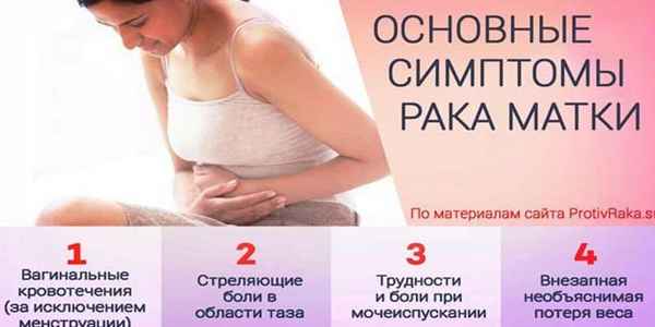 Paк шейки матки: симптомы, признаки, сколько живут, стадии 