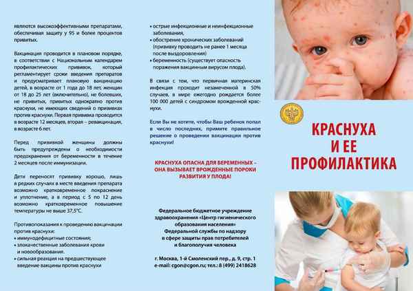 Краснуха у детей и взрослых: симптомы, прививки, лечение и профилактика 