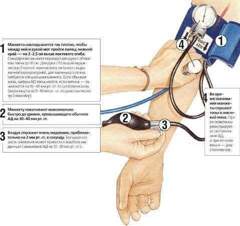 Как измерить артериальное давление механическим тонометром