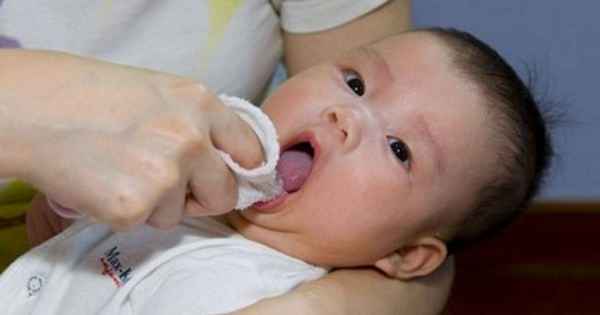 Белый налет во рту у ребенка - почему появляется, как лечить медикаментами и народными средствами
