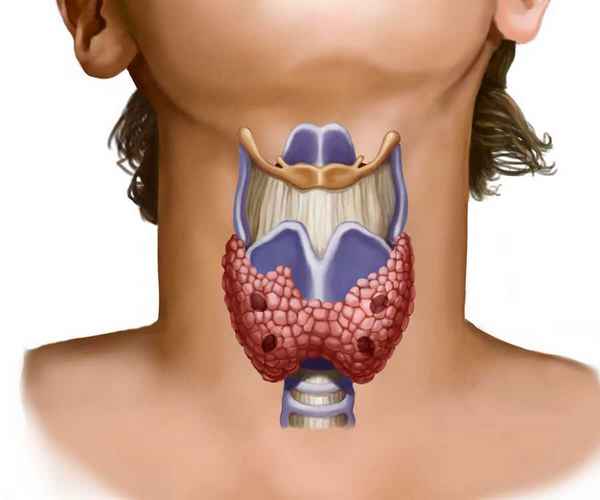 Щитовидная железа | 